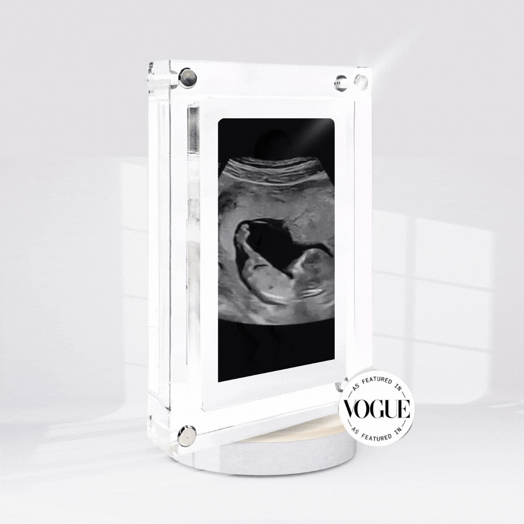 The FirstCapture™ Live Ultrasound Frame